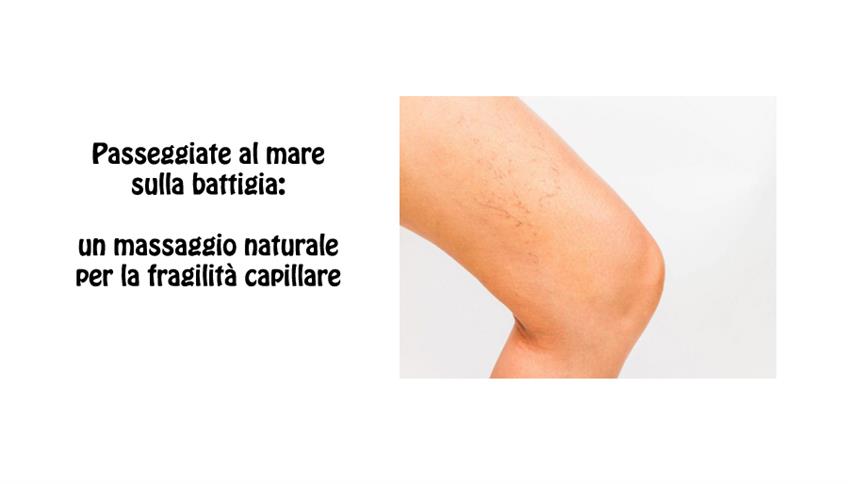 Capillari sulle gambe Capillari sulle gambe
